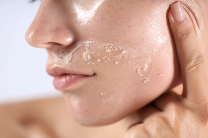 Common Skincare Mistakes That Make Dry Skin Worse (And How to Fix Them)
