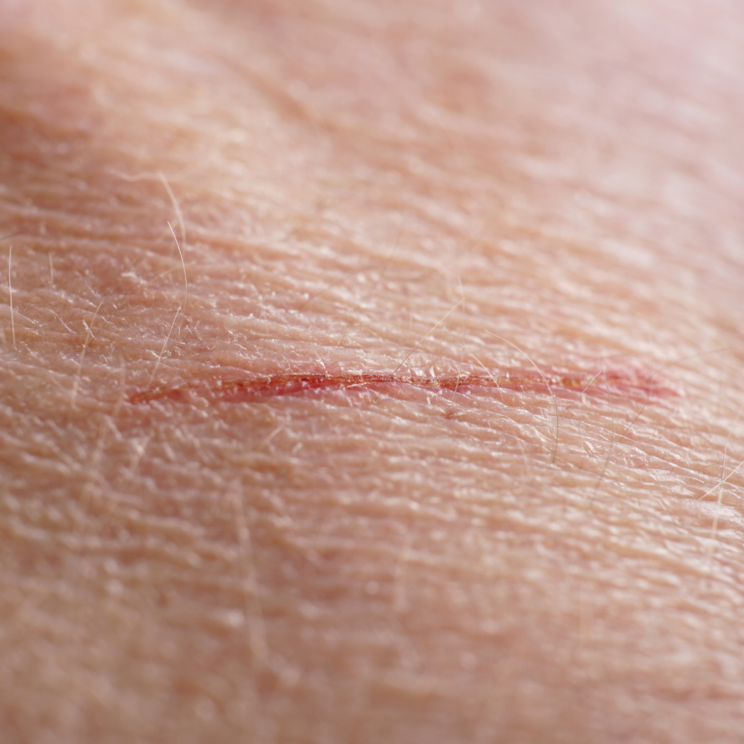 Can lanolin protect and heal skin cuts?
