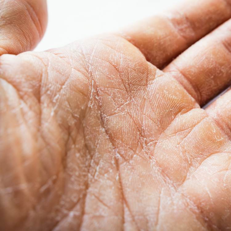 Pure Lanolin from New Zealand Skin Healing Global Delivery NZ Naturally